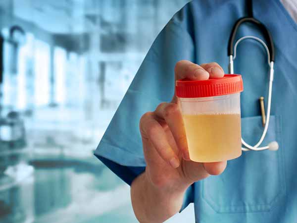 Ada sejumlah fakta urin yang masih jarang diketahui