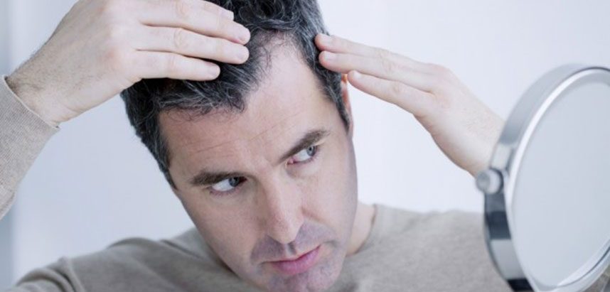 Ternyata 5 Permasalahan pada Rambut Ini Bisa Deteksi Kondisi Kesehatan Lho!