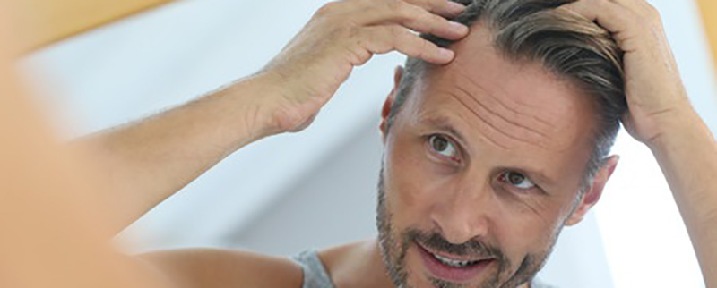 Deteksi Gangguan Kesehatan pada Tubuh dari 5 Masalah Rambut Ini!